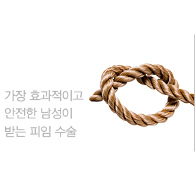 정관수술